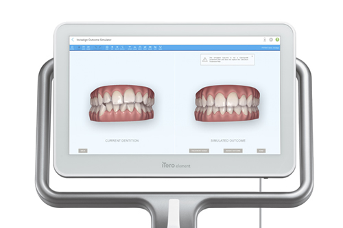 シミュレーション