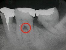 根本の黒くなった様子